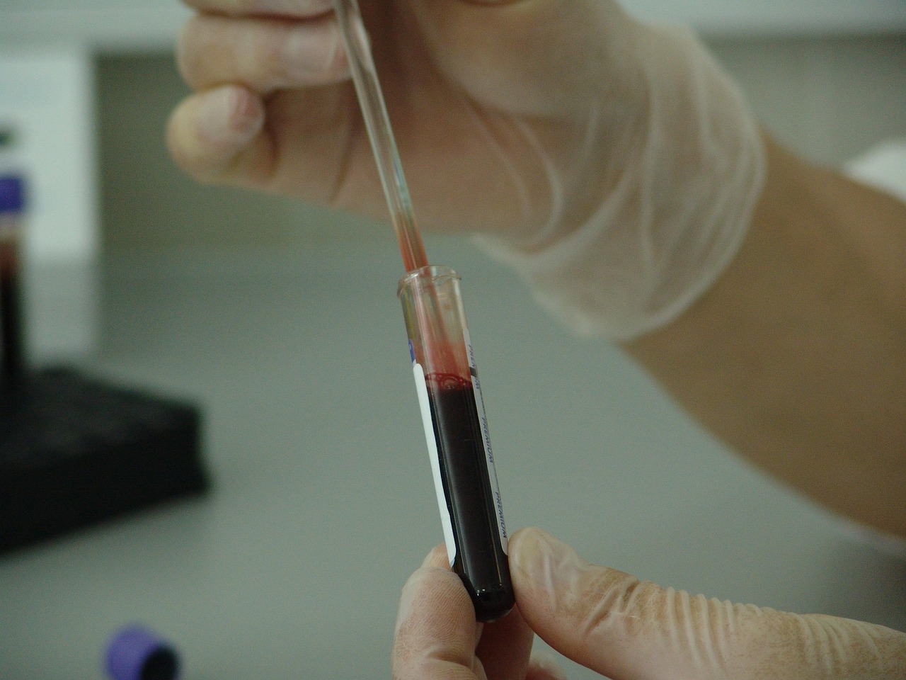 blood-20745_1280